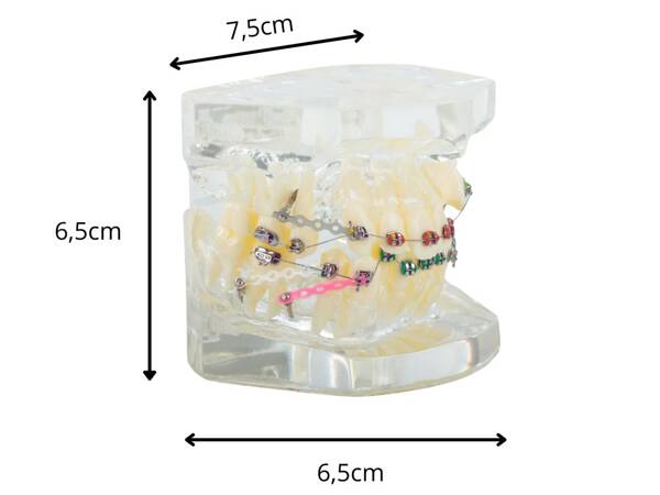 Dental model jaw teeth teeth braces