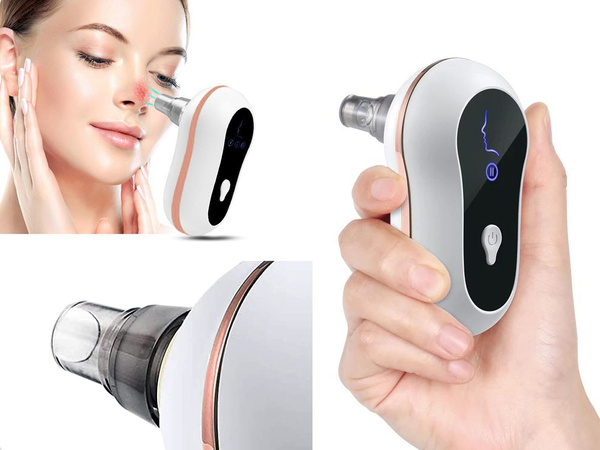 Hoover for blackheads microdermabrasion