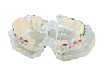 Dental model jaw teeth teeth braces