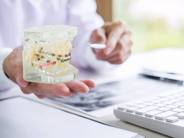 Model dentar maxilar dinți dinți aparate dentare