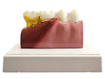Anatomical model of a dental tooth educational cross-section removable tooth