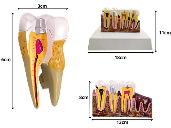 Anatomical model of a dental tooth educational cross-section removable tooth