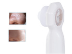 Aspirateur de points noirs et de boutons loupe led