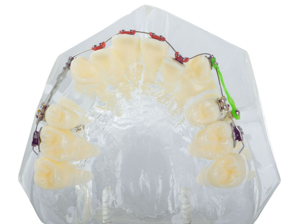 Modèle dentaire dents de la mâchoire appareils dentaires