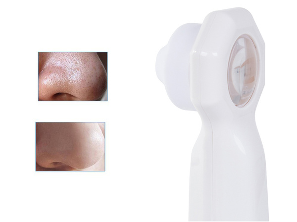 Melngalvju un pimple hoover rezultātā lupu