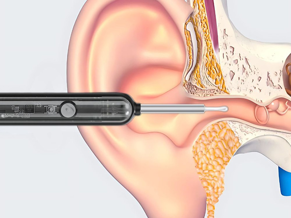 Endoskop otoskop mit wifi-kamera für ohr reinigungstools smart kit