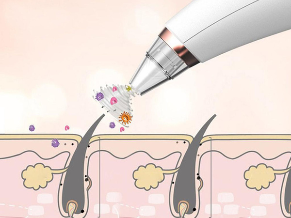 Blackhead extractor blackhead extractor