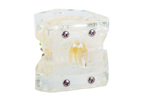 Dantų modelis žandikaulio dantys dantų breketai