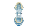 Dental model jaw teeth teeth implants