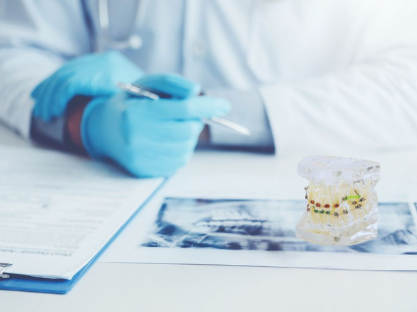Model dentar maxilar dinți dinți aparate dentare
