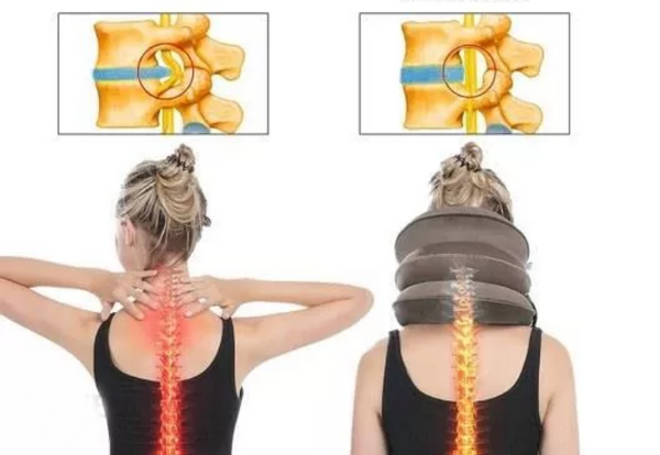 Orthopädisches nackenzugkissen drei stufen