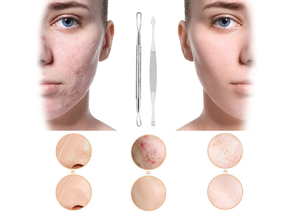 Sada speakerů pro odstranění skalkulárních mucků x 7