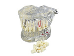 Dental model jaw teeth teeth implants