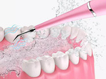 Scaler dentar cu ultrasunete pentru tartru
