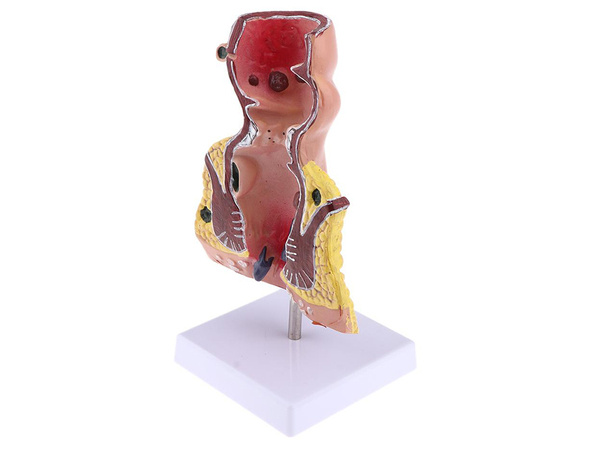 Model anatomiczny odbytu hemoroidy powiększenie 5x