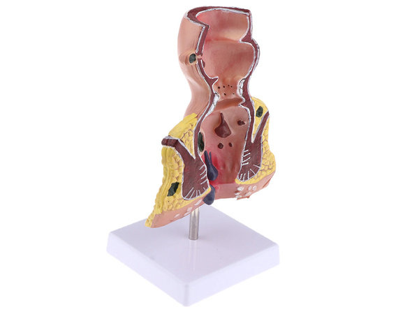 Model anatomiczny odbytu hemoroidy powiększenie 5x