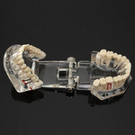 Model stomatologiczny szczęka zęby zębow implanty