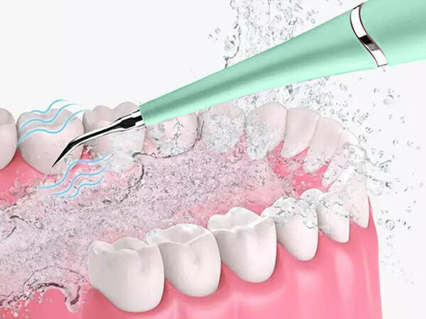 Scaler dentar cu ultrasunete pentru curățarea dinților îndepărtarea tartrului