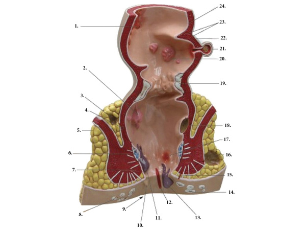 Modelo anatomico de ano hemorroides aumento 5x